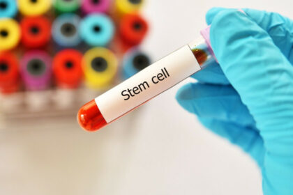 the-benefits-of-stem-cell-therapy-in-dubai:-anti-aging-and-regenerative-medicine-at-aeon-clinic